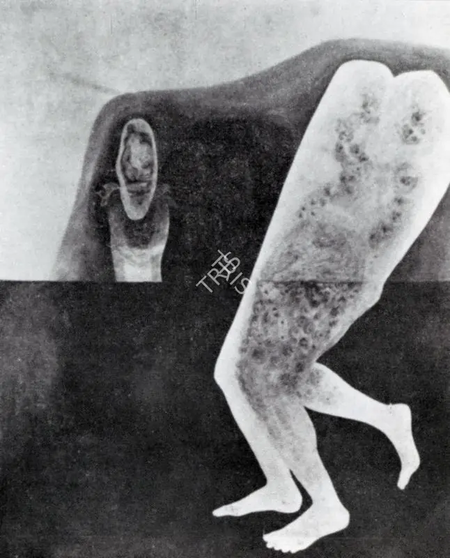 Sanathanan, M. (Artist). Mask. n.d. | Artrends, July-October 1980 - January-April 1981 | Painting | FineArts | 00551664