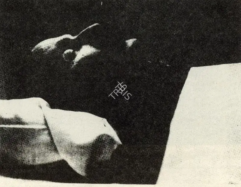 Unknown (Photographer). Andrei Tarkovsky on his death bed, n.d. | Contemporary Photograph