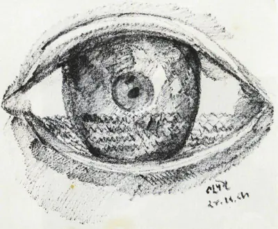 Khakhar, Bhupen P. (Artist). Eye with Cataracts, 1989 | Drawing