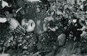 Rai, Raghu (Photographer), Bhopal Child, 1984 | Contemporary Photograph