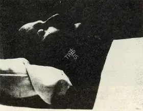 Unknown (Photographer). Andrei Tarkovsky on his death bed, n.d. | Contemporary Photograph