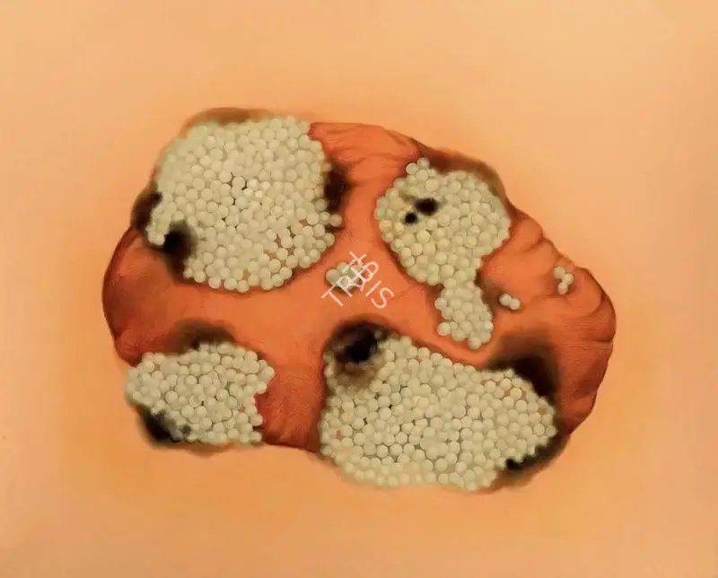 Prajakta Potnis (Artist), Studded, 2008, Painting