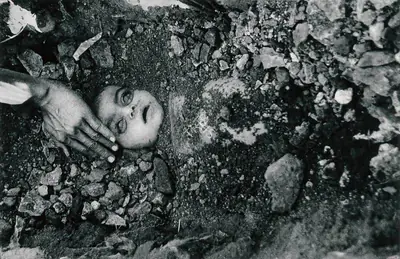 Raghu Rai (Photographer), Bhopal Child, 1984, Contemporary Photograph