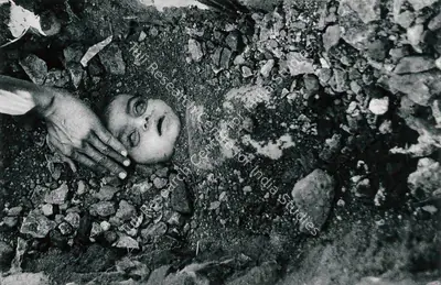 Raghu Rai (Photographer), Bhopal Child, 1984, Contemporary Photograph